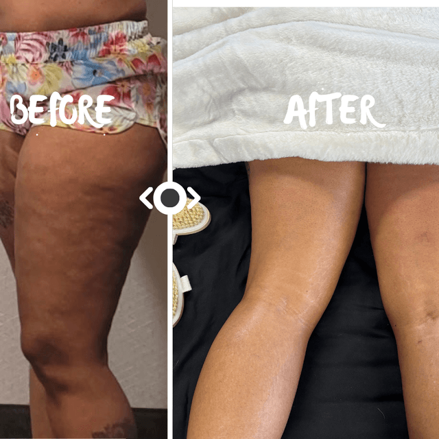 Slim Down Weight Loss & Body Sculpt